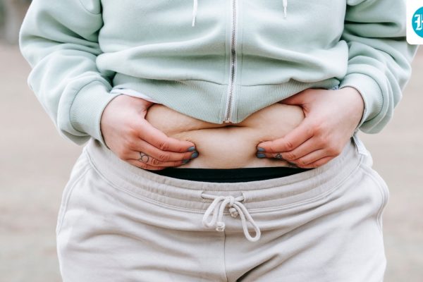 obesity_1785942383823_1785942383978_f7cd02ce-24f9-4a1f-867f-820a651ff042